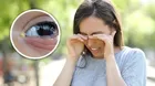 Conjuntivitis: Conoce cómo se contagia, sobre todo en verano