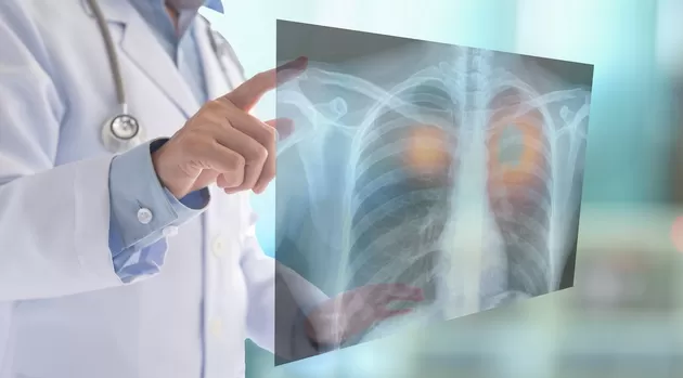 ¿Cómo saber si tengo problemas en los pulmones por COVID-19?