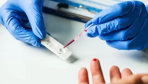 Escucha la explicación del Dr. Elmer Huerta