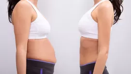 Liposucción: ¿en qué consiste la técnica para eliminar la grasa corporal?