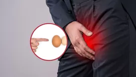 ¿Qué es el cáncer de pene y qué síntomas deben preocuparte?