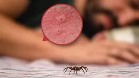 ¿Qué es lo peor que te puede pasar si te pica una malagua?