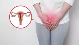 Cáncer de cuello uterino: causas y síntomas que debes conocer