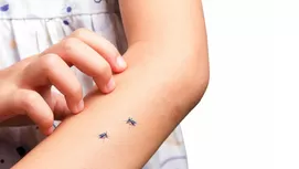 ¿Por qué las palomas no se electrocutan en los cables eléctricos? 