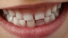 ¿Desde qué edad y cómo debes cepillar los dientes de tu bebé?