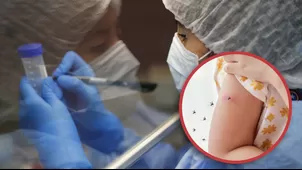 ¿Cuáles son las pruebas para detectar el dengue?