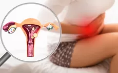 6 señales de endometriosis y que confundes con dolor menstrual - Noticias de ministerio-salud
