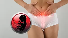 ¿Por qué la menstruación puede tener mal olor?