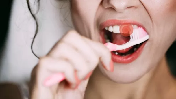 El sangrado de encías es uno de los síntomas visibles de la gingivitis.