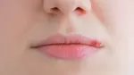 ¿Cuáles son las causas del herpes labial?