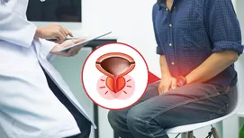 Cáncer de próstata: cómo descartarlo sin el examen de tacto rectal