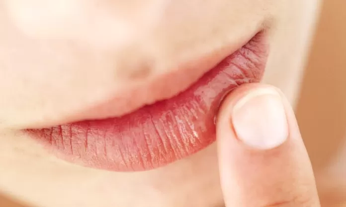 ¿por Qué Se Resecan Los Labios Y Cómo Cuidarlos América Noticiasemk 5173