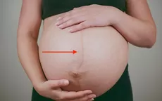 ¿Por qué aparece una línea marrón en el vientre y cuándo se borra? - Noticias de maternidad