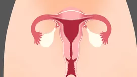 ¿Cómo saber si tienes miomas en el útero?