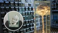 Museo del cerebro que expone órganos reales y enfermedades