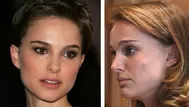 Esta es la dieta de Natalie Portman para acabar con su acné