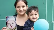 Operación Sonrisa, junto al Hospital Nacional Daniel Alcides Carrión, realizará 85 cirugías reconstructivas gratuitas.