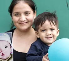 Operación Sonrisa, junto al Hospital Nacional Daniel Alcides Carrión, realizará 85 cirugías reconstructivas gratuitas.