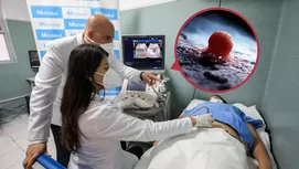 Cáncer de cuello uterino: causas y síntomas que debes conocer