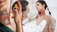 ¿Es peligroso para la tiroides aplicarse perfume en el cuello?