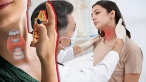¿El perfume daña la tiroides? La Dra. Maria Alejandra Quispe aclara este mito médico.