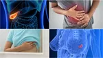 ¿Es posible que el cáncer haga metástasis y no muestre síntomas?