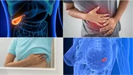 ¿Una persona que tiene cáncer y hace metástasis puede sobrevivir?