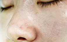 ¿Tienes textura en tu piel? 5 tips efectivos para un rostro lindo - Noticias de sunarp