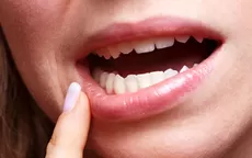 ¿Por qué salen aftas en la boca y cómo puedes prevenirlas? - Noticias de enfermedades