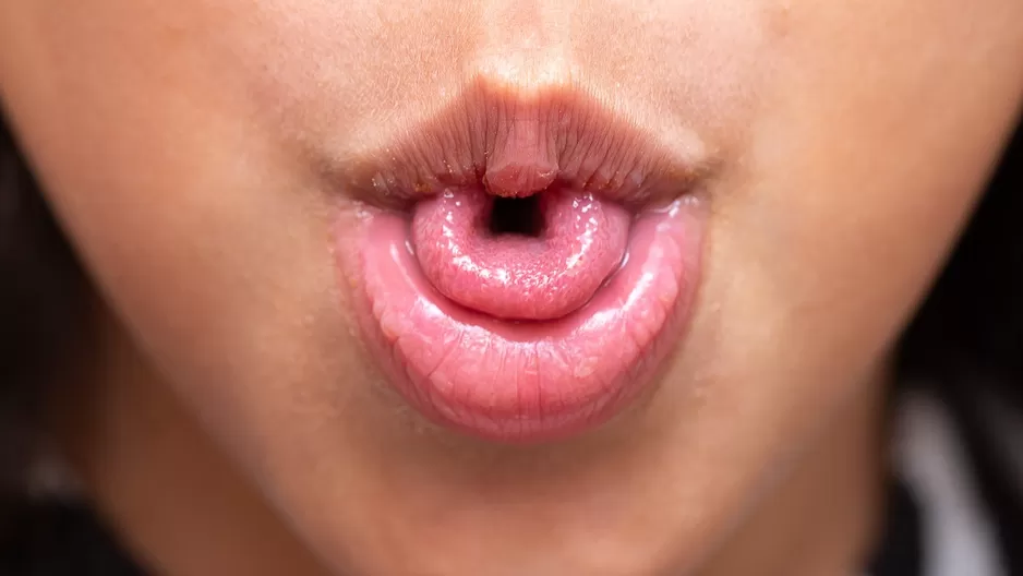 ¿No puedes doblar la lengua como los demás?