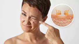 ¿Quieres bajar la papada y cachetes? Alimentos que debes evitar