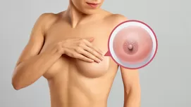 Por qué se oscurece el pezón y qué consecuencias tienen