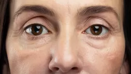 Cómo quitar lo hinchado de los ojos luego de haber llorado