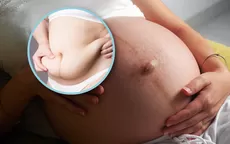 ¿Por qué se sale el ombligo durante el embarazo? - Noticias de embarazo