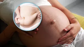 ¿Por qué el ombligo huele feo y cómo puedes evitarlo?