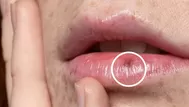 ¿Por qué te salen manchas en los labios?