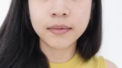 ¿Por qué te salen manchas oscuras en tus labios?