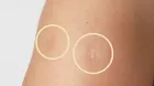 ¿Por qué tienes esta cicatriz en el brazo?