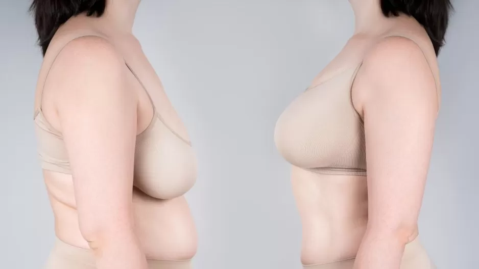 Causas de la caída de senos más allá de la edad.