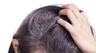 Primeras canas: lo que nunca debes hacer para evitar perder cabello