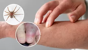 El tipo de araña que causa accidentes en invierno.