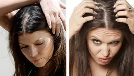 ¿Cómo saber si tu pérdida de cabello está dentro de lo normal?