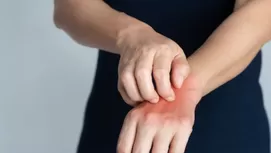 ¿Qué pasa cuando te lavas las manos muy seguido?