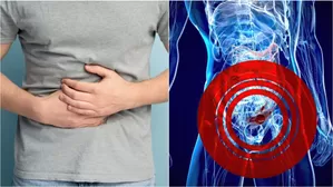 Conoce el tratamiento para la diverticulitis antes de la cirugía.