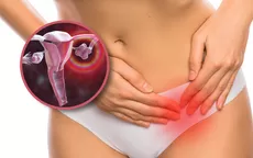 ¿En qué casos los quistes en el ovario producen dolor? - Noticias de ropa