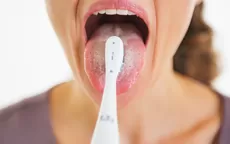 ¿Por qué mi lengua se pone blanca pese a que la limpias o cepillas? - Noticias de avion