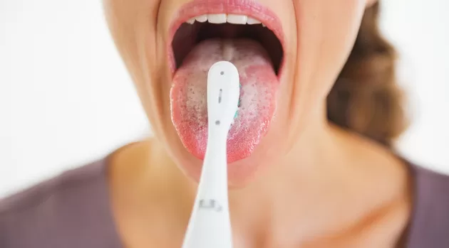 ¿Por qué mi lengua se pone blanca pese a que la limpias o cepillas?