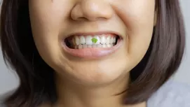 ¿Cómo evitar los dientes chuecos y una mala mordida en tus hijos?