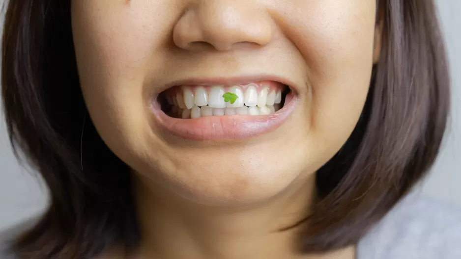 La comida que se queda atrapada entre los dientes no es normal