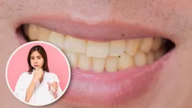 ¿Por qué nunca debes compartir tu cepillo de dientes?